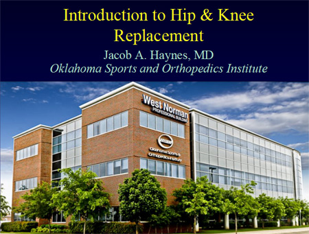 Introduction to Hip & Knee Replacement