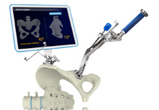 Computer-assisted Hip Replacement