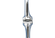 Correction of a Failed Knee Replacement